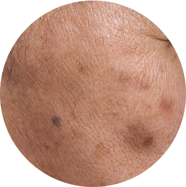 Dark Spots