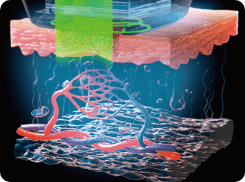 Laser Irradiation