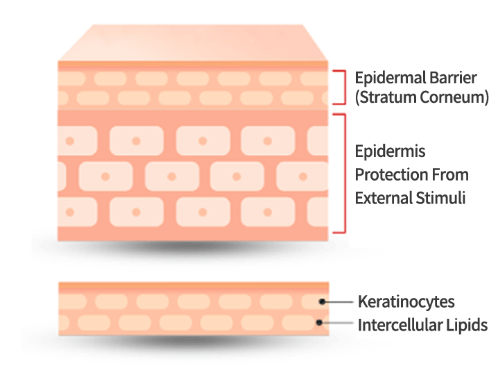 Epidermal Barrier (Stratum Corneum), Epidermis Protection From External Stimuli, Keratinocytes, Intercellular Lipids