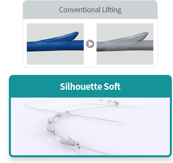 Conventional Lifting, Silhouette Soft
